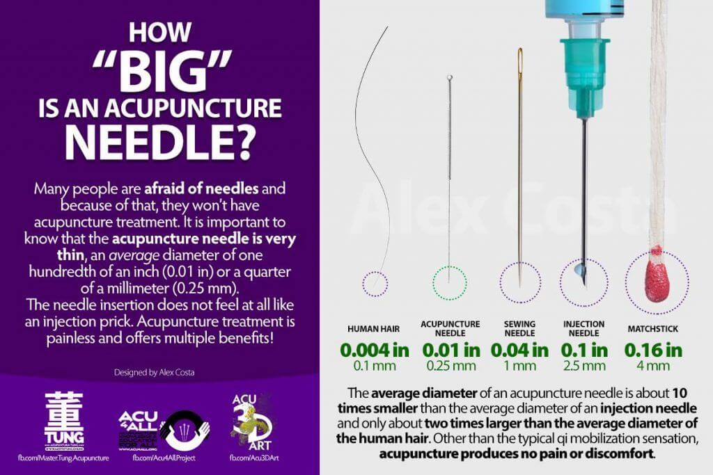 size of acupuncture needles compared to a strand of hair, sewing needle, hypodermic needle, and matchstick